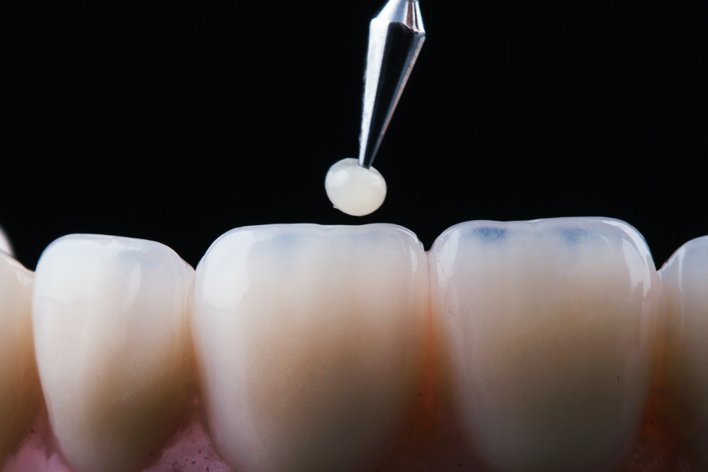 Dentística Restauradora: Restaurando a Saúde e a Estética do Seu Sorriso