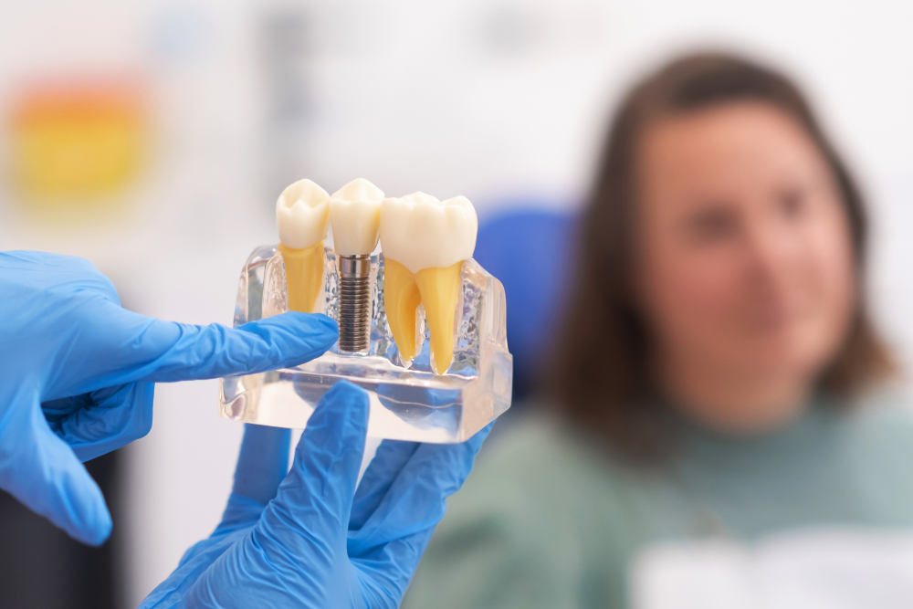 Implante Dentário: A Solução Definitiva para a Perda de Dentes